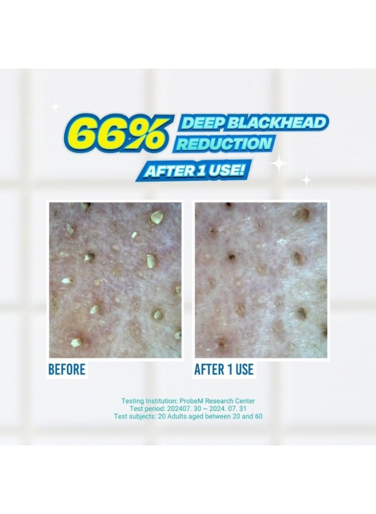 JUMISO Blackhead Melting Softener Kit 150ml – علاج إزالة الرؤوس السوداء وتنقية المسام - Image 5